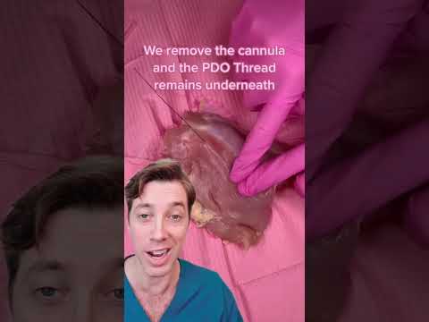 Do PDO Threads really work?