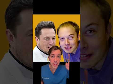 Elon Musk’s Hair Transplant Transformation: Hair Surgeon’s Analysis