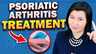 Best Psoriatic Arthritis Treatments