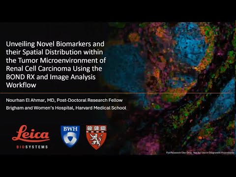 Unveiling Novel Biomarkers and their Spatial Distribution within the Tumor Microenvironment of...