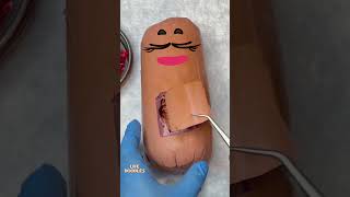 Life Doodles | The sausage operation 😂 #Fruitsurgery #doodles #lifedoodles #shorts #shortvideo