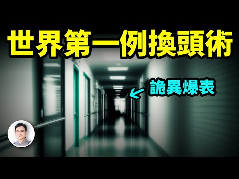 人類首例換頭手術已獲突破；過程中發生了什麼？背後那些驚悚的故事【文昭思緒飛揚353期】