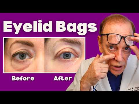 How to Get RID of Under Eye Bags Like A Facial Plastic Surgeon