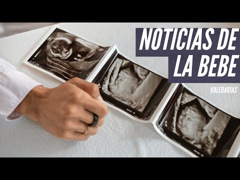 QUE HA PASADO CON LA BEBE? - Tenemos noticias del equipo Medico.