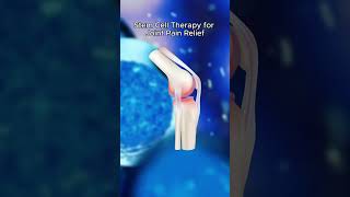 Relieve joint pain and heal naturally with stem cell therapy. 🌿 #JointPainRelief