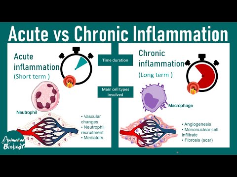 Acute vs Chronic inflammation | differences between acute and chronic inflammation | USMLE step 1