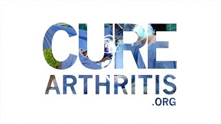 Osteoarthritis Treatment May Eliminate Joint Replacements