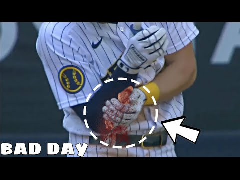 MLB- Worst Hit-By-Pitch