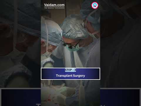 What Are the Steps in a Liver Transplant?