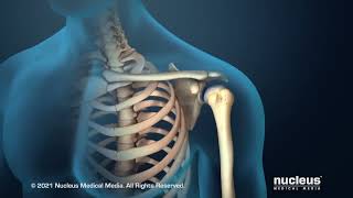 Shoulder Arthritis Pain