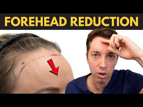 Forehead Reduction Surgery | Hairline Lowering