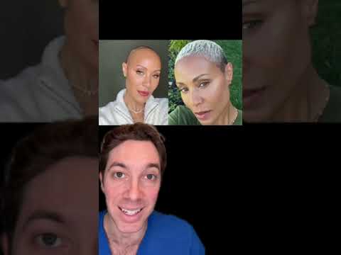 Jada Smith's Battle with Alopecia Areata