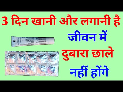 जीवन में दुबारा छाले नहीं होंगे, 3 दिन इस्तेमाल करना है बस | orafast tablet, oracraft gel uses