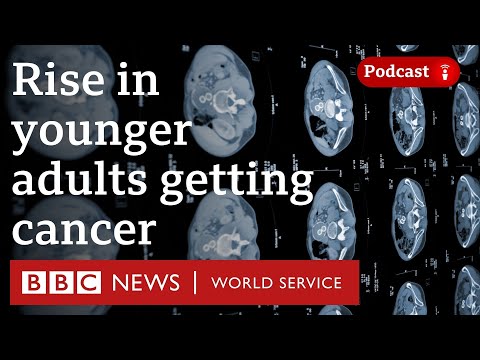 Why are more adults than ever getting cancer younger? - The Global Story podcast, BBC World Service