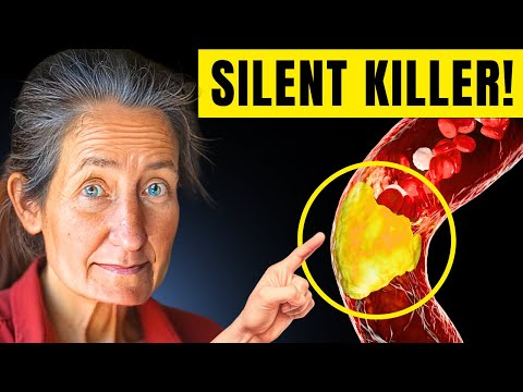 UNCLOG Your Arteries Naturally: "PREVENT Heart Disease and Stroke INSTANTLY!"| Barbara O'Neill