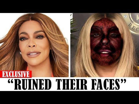 Famous Black Celebs Who Destroyed Their Faces With Plastic Surgery