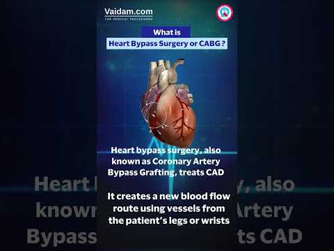 What is heart bypass surgery ? #heartbypasssurgery #trending #viralshorts #trendingshorts