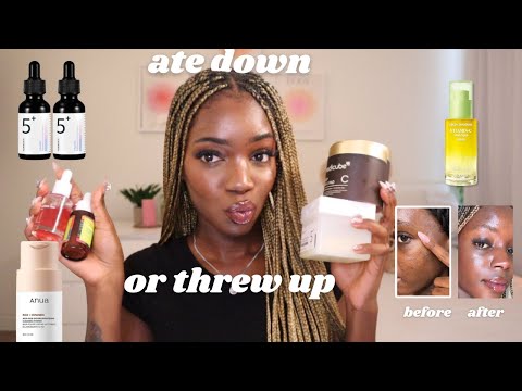 ranking EVERY viral skincare product for acne scars and dark spots… an HONEST review 🎀🫧