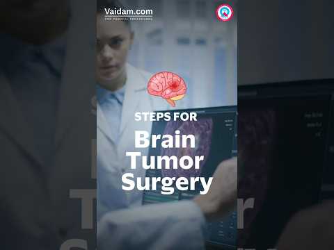 Brain Tumor Surgery in India: Step-by-Step Breakdown #trending #shorts #viralvideo #health