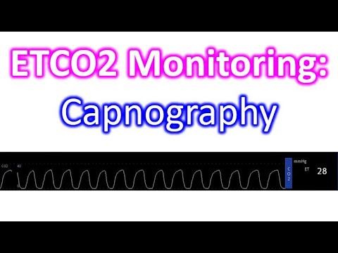 ETCO2 Monitoring: Capnography