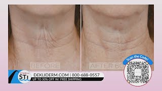 Take the 60-day Dekliderm challenge and experience youthful skin