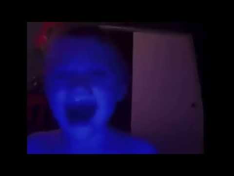 Kid turns blue and dies