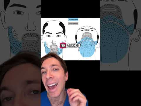 What is a Beard Hair Transplant? | Hair Surgeon Explains