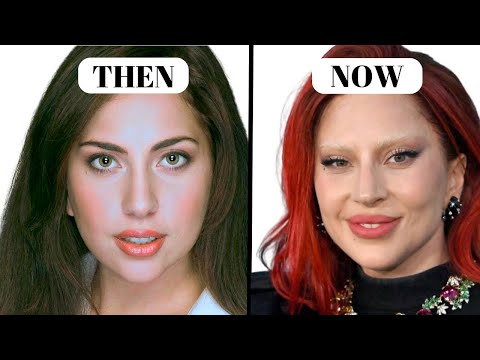 Lady Gaga’s NEW LOOK | Plastic Surgeon Reacts