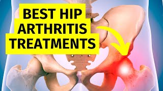 The Best Hip Arthritis Treatments Without Surgery