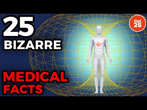 25 Bizarre Medical Facts