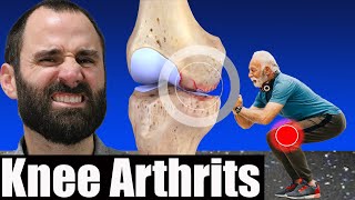 Managing Knee Osteoarthritis: Top Strategies for Pain Relief and Joint Health