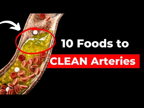 How to Clean Your Arteries Naturally