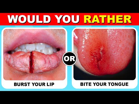 Would You Rather...? 100+ HARDEST Choices Ever! 😱😨 QuizZone