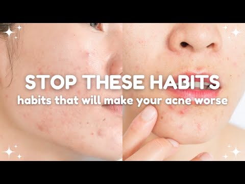 habits that are making your acne worse 🫧🧴 stop these habits!