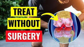 The Best Knee Arthritis Treatments Without Surgery