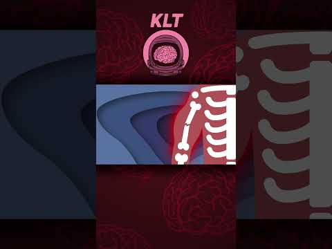 Learn How Bones Heal! | Human Body Songs For Kids | KLT Anatomy #shorts